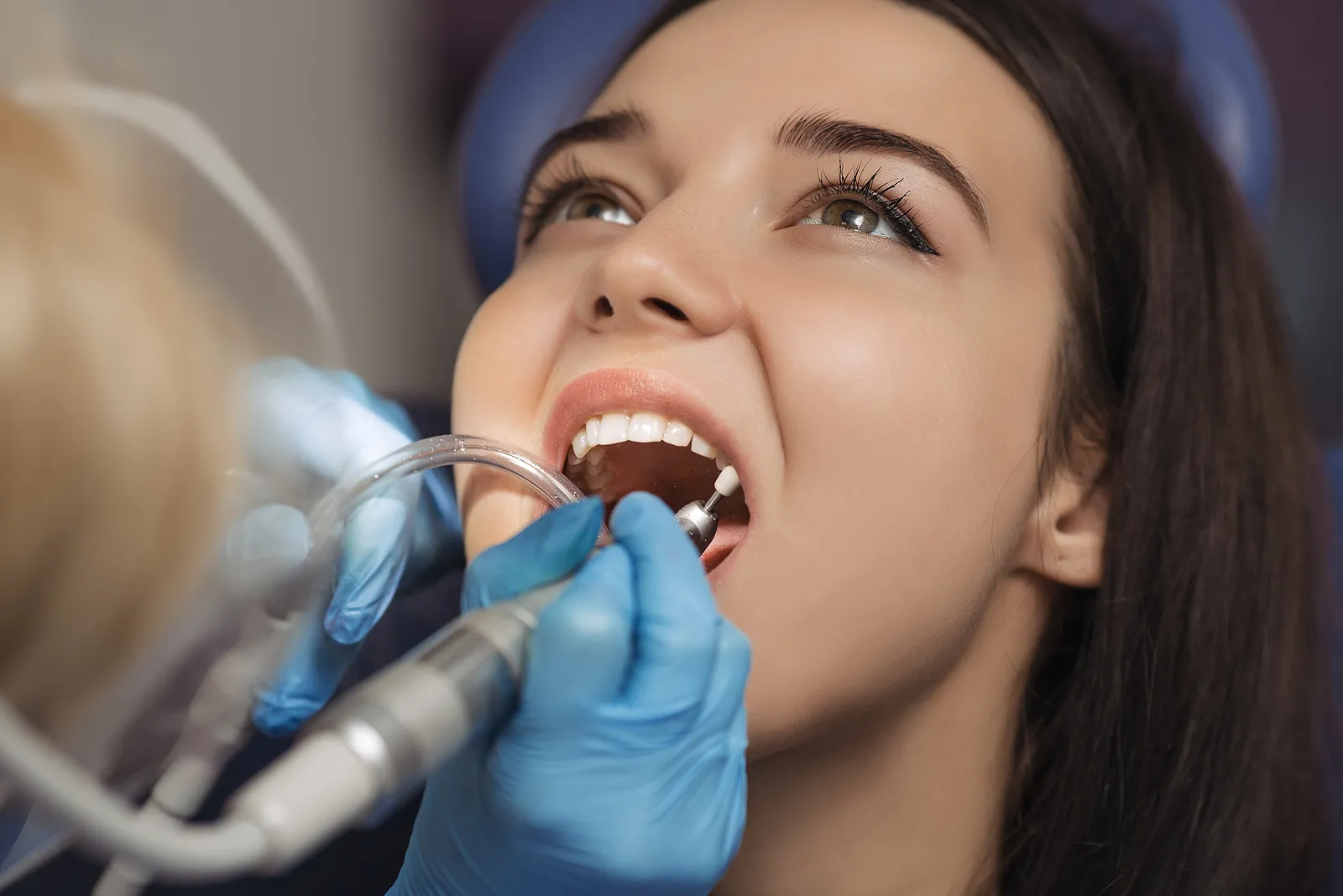 Essential Tips for Caring for Your Dental Implants